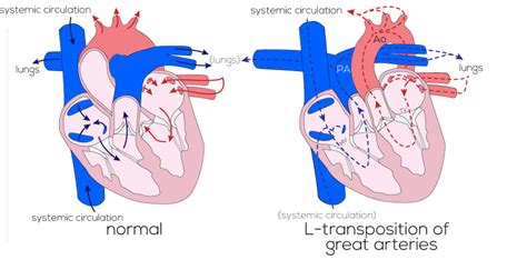 Afbeeldingsresultaten voor Corrected Transposition