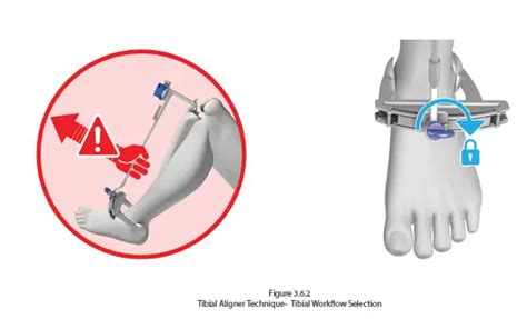Afbeeldingsresultaten voor Computer Assisted Instrument Definition