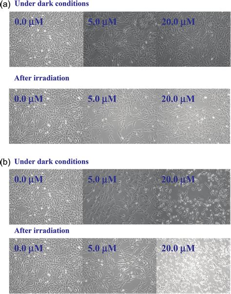 Toradh íomhá ar Phase Contrast Microscope Magnification