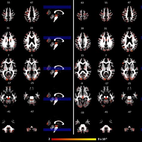 Spatial Patterns World Map に対する画像結果
