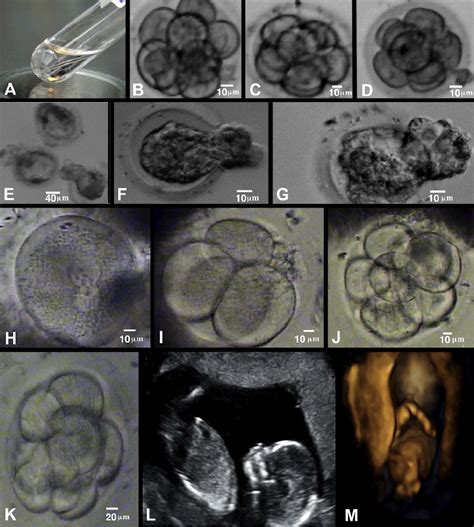Image result for Human Embryo Electron Microscope