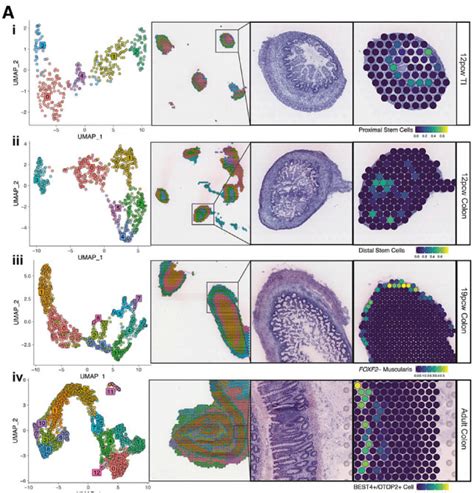 Image result for Spatially Resolved Transcriptomics