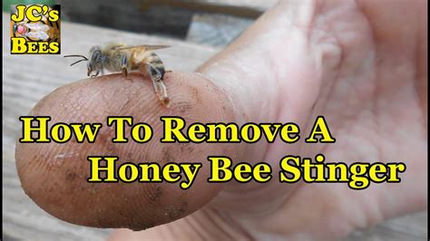 Image result for How to Remove a Bee Stinger