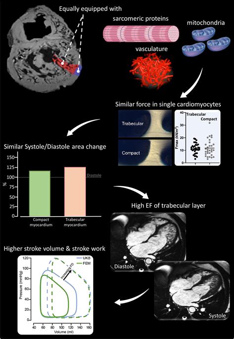 Graph Abstract Heart Trabeculation に対する画像結果