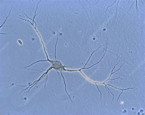 Image result for Neuron Cell Light Microscope