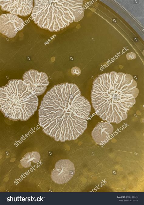 Image result for Bacillus Subtilis On EMB Agar