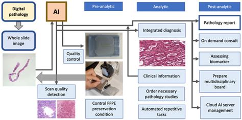 Afbeeldingsresultaten voor Clinical Machine Learning Workflow
