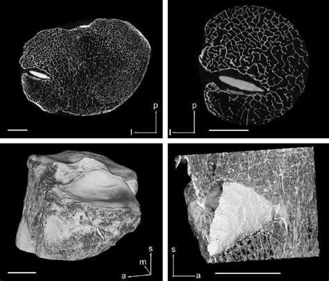 Image result for High Resolution CT Scan