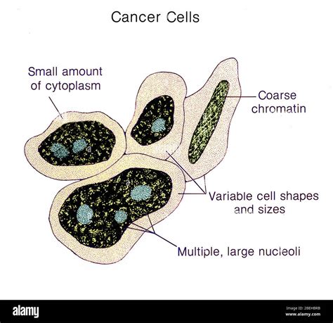 Image result for Cancer Cell Structure