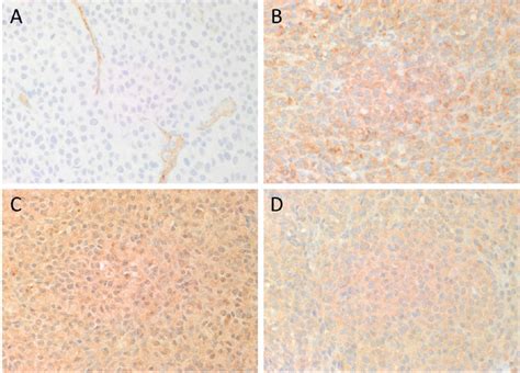 Image result for DAB Immunohistochemistry