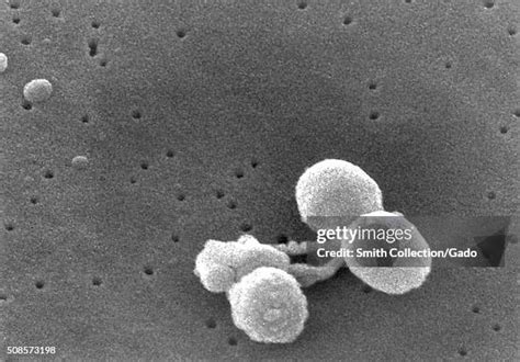 Image result for Strep Gram-positive