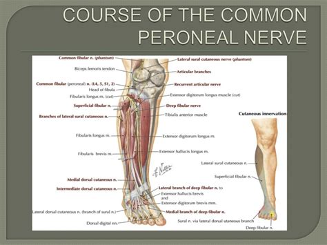 Common Peroneal Nerve Dysfunction ಗಾಗಿ ಇಮೇಜ್ ಫಲಿತಾಂಶ