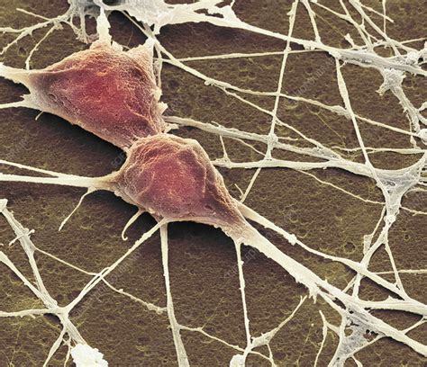 Neuron Under Electron Microscope に対する画像結果