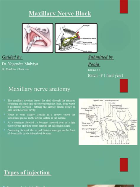 Image result for Maxillary Nerve Block