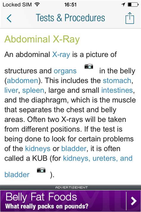 Image result for WebMD Medical Conditions