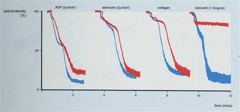 Image result for Normal Platelet Aggregation Graph