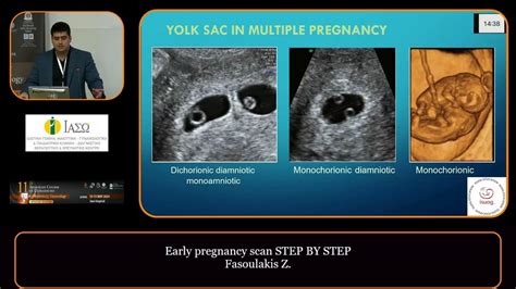 Toradh íomhá ar Basic Ultrasound Training