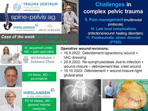 Pelvic Trauma に対する画像結果