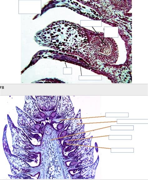 Image result for Female Cone Diagram