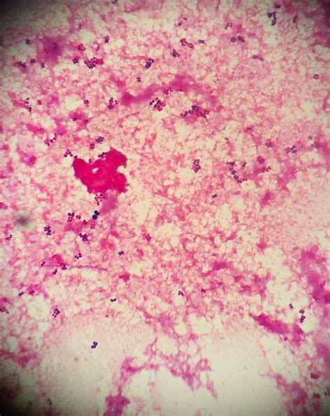 Enterococcus Gram-positive Cocci に対する画像結果
