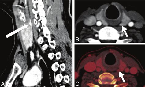 4D CT Scan Radiology に対する画像結果