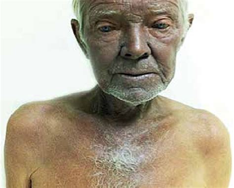 Toradh íomhá ar Skin Diffuse Color