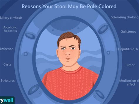 Image result for Rusty Color Diarrhea