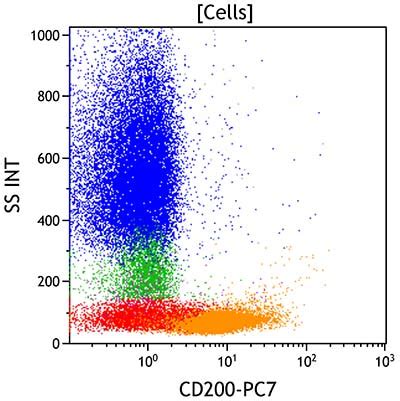 Image result for Lymphoma Flow Cytometry Panel