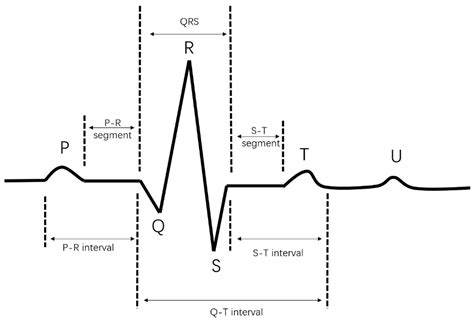 Hand Based ECG Signal に対する画像結果