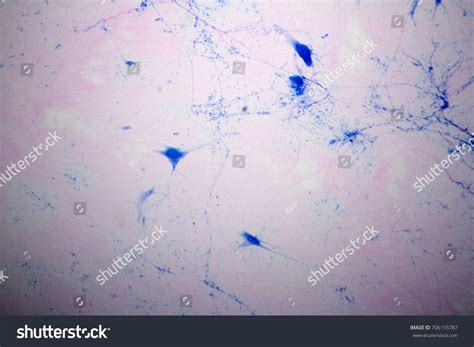 Image result for Giant Multipolar Neuron Microscope