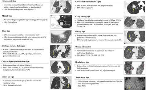 Chest CT Radiographic Sign Table に対する画像結果