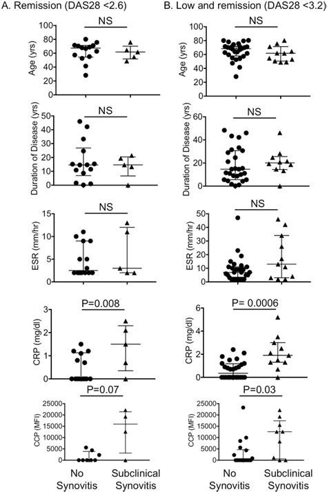 Image result for Subclinical Synovitis