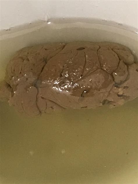 Image result for Extremely Hard Poop