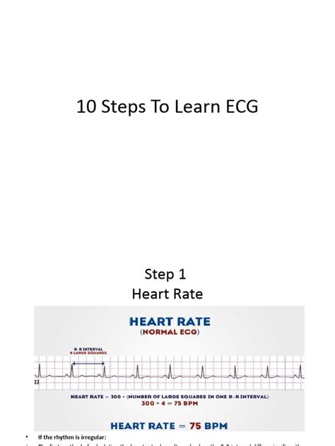 Image result for ECG Step by Step Guide