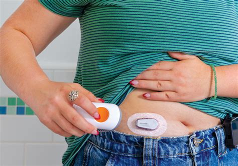 How to Apply a Dexcom Sensor Step by Step に対する画像結果