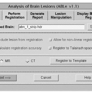 MRI Registration Python に対する画像結果