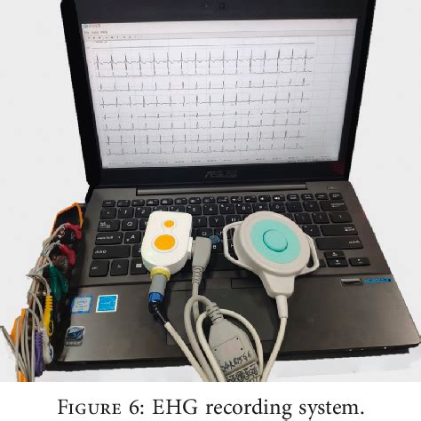 Ehg SE System Control Unit に対する画像結果