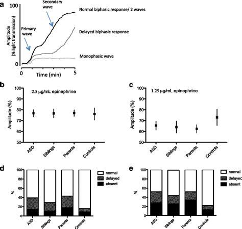 Toradh íomhá ar Normal Platelet Aggregation Graph