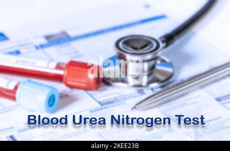 Urea nitrogen test Stock Photo - Alamy