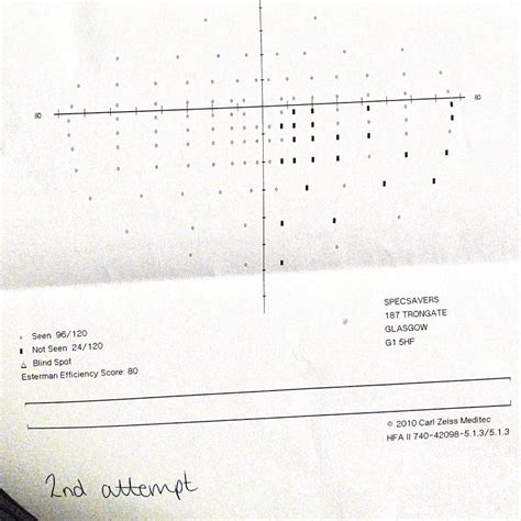 Visual Acuity Test Form DVLA に対する画像結果