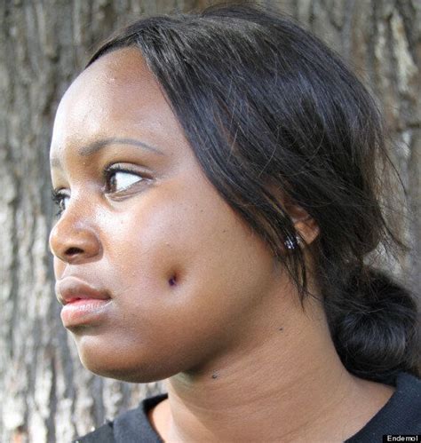 Image result for What Is a Dimple