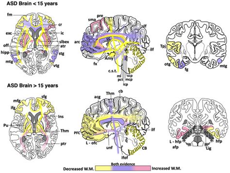Brain Development Disorders に対する画像結果