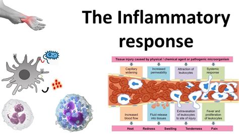 Toradh íomhá ar Inflammation Pathophysiology