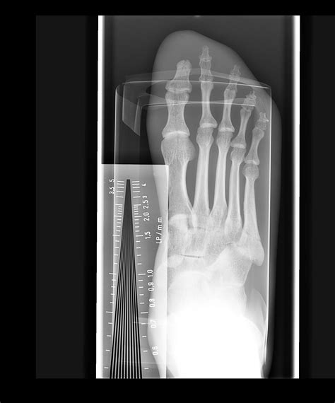 Spatial Resolution Radiography Examples के लिए छवि परिणाम