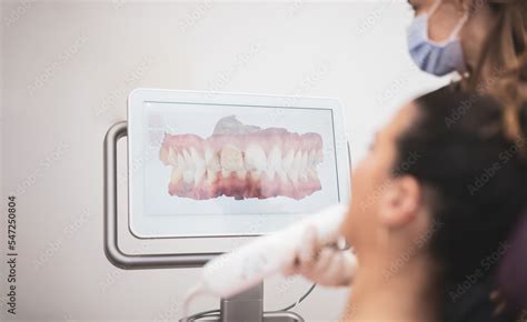 Image result for 3D Teeth Scanner