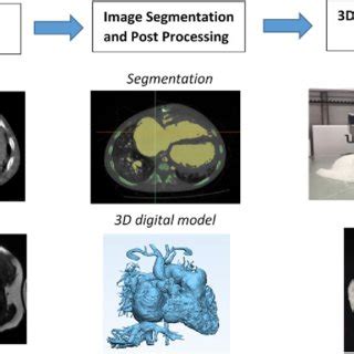 Image result for 3D Printed Heart Diagram