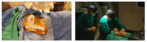 What Are Medical Imaging Software's に対する画像結果