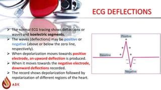 Image result for Positive and Negative Deflection ECG