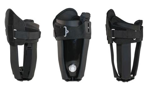 Image result for Direct Socket Prosthesis