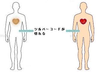 Permanent Death に対する画像結果